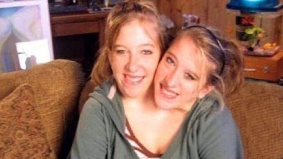 Is Abby And Brittany Pregnant In 2024? Abby And Brittany Pregnant and